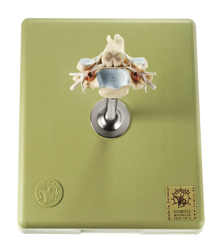 SOMSO Cervical Vertebra (C VI) with Spinal Cord