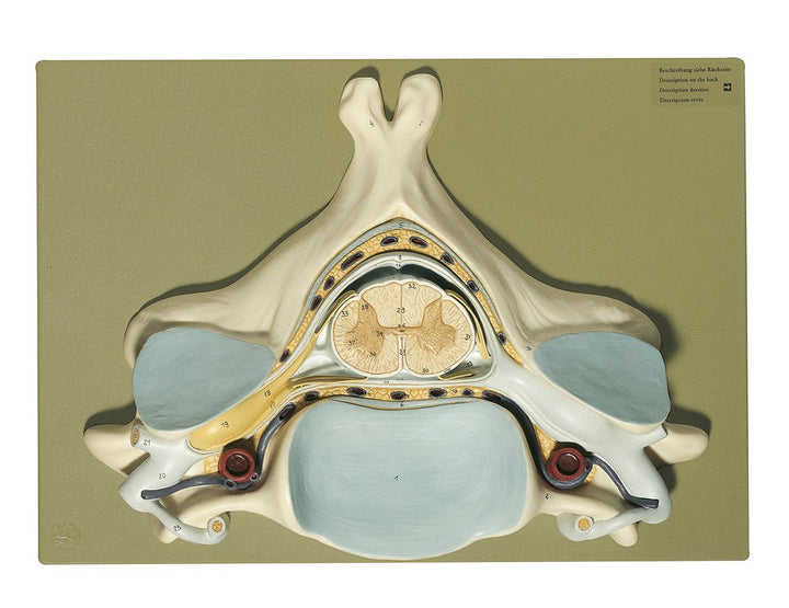 SOMSO Fifth Cervical Vertebra