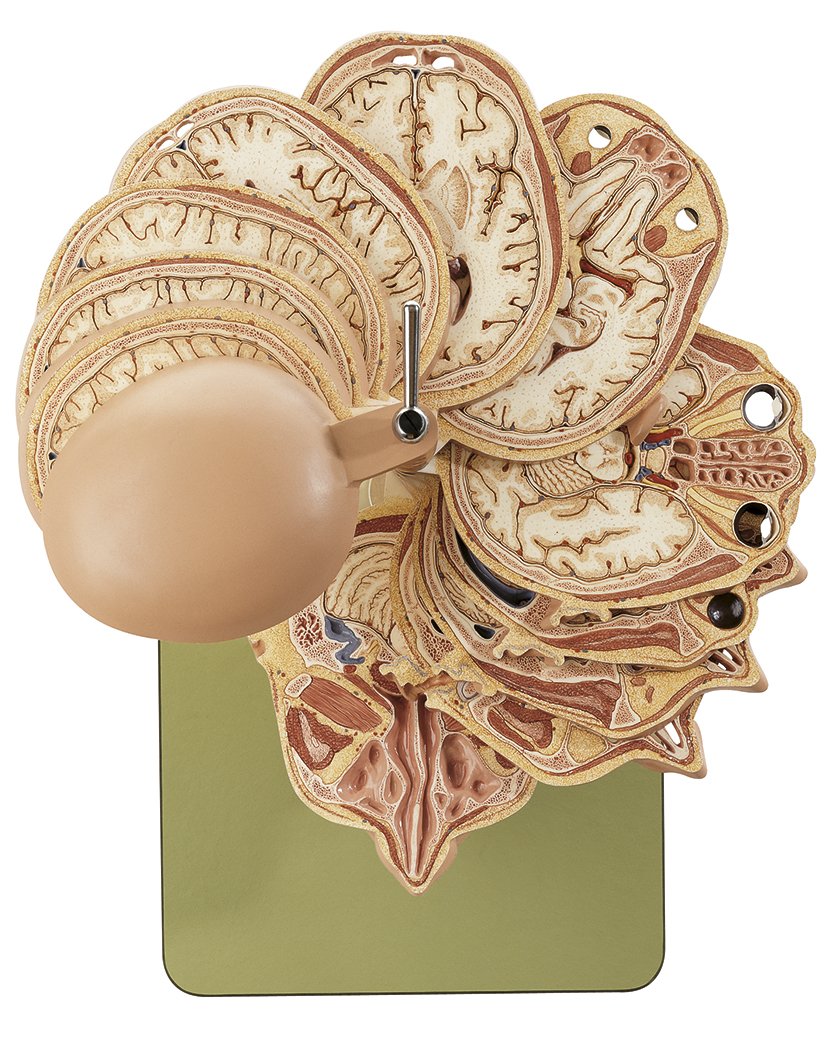 SOMSO Anatomical Sectional Model of the Head (combined with corresponding MR-Figures)