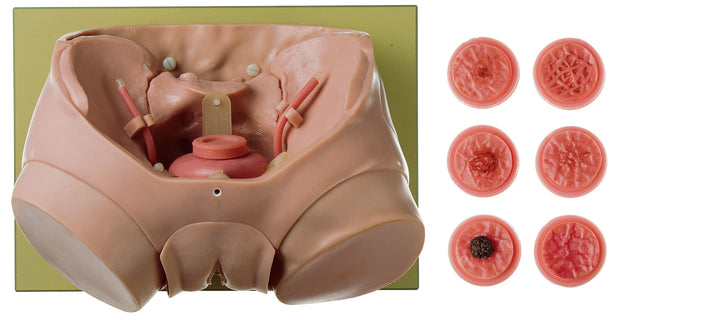 SOMSO CLA-Bladder Phantom for Endoscopy