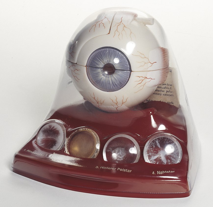 SOMSO Cataract Eye Model