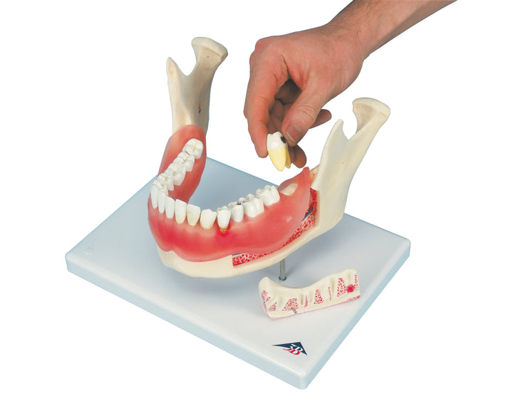 3B Diseases of the Teeth