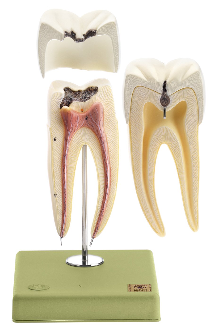 SOMSO Lower Molar with Two Roots