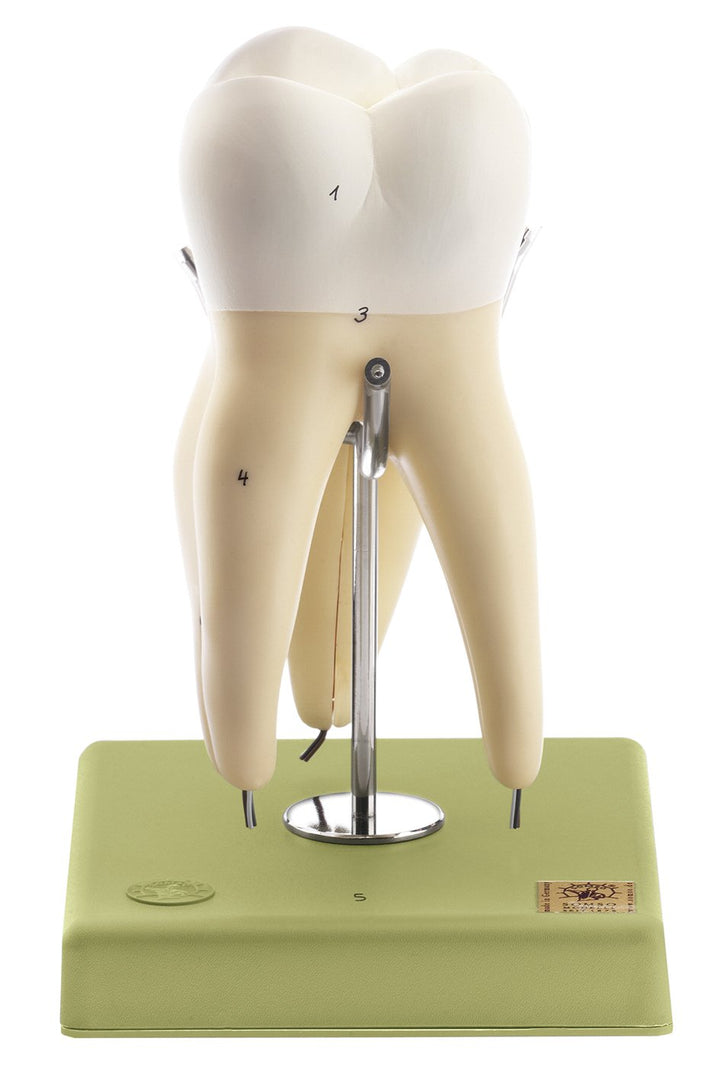 SOMSO First Upper Molar with Three Roots