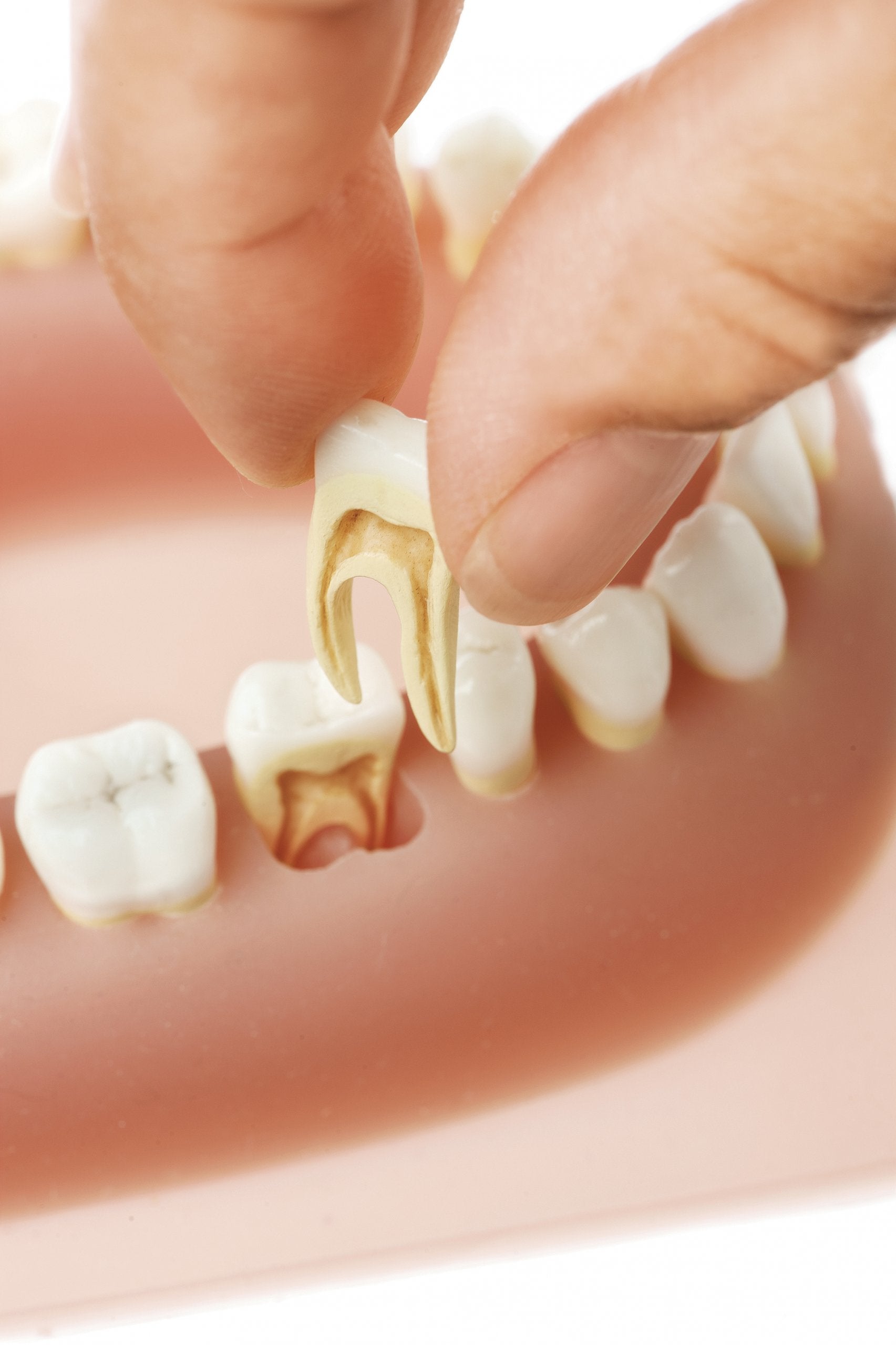 SOMSO Set of Teeth of an Adult