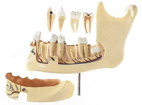 SOMSO Lower Jaw of an 18-Year-Old