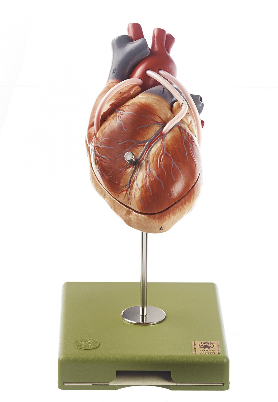 SOMSO Model of the Heart with Bypass Vessels (Aortic Coronary Venous Bypass)
