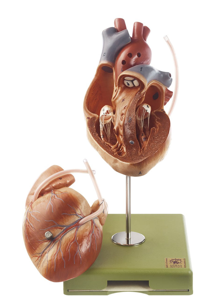 SOMSO Model of the Heart with Bypass Vessels (Aortic Coronary Venous Bypass)