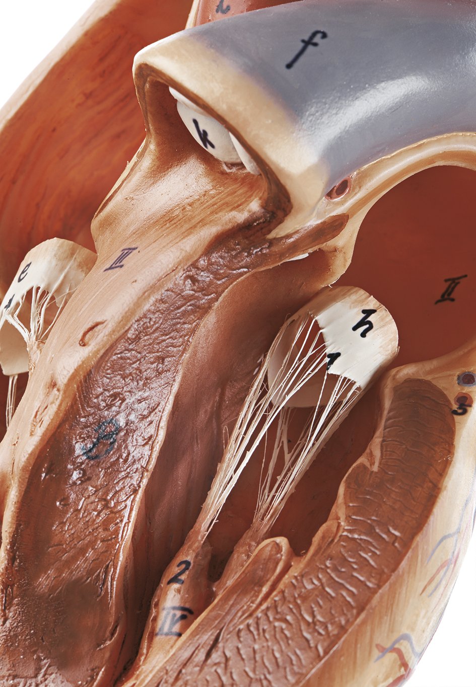 SOMSO Model of the Heart with Bypass Vessels (Aortic Coronary Venous Bypass)