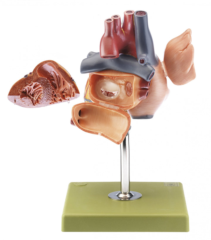 SOMSO Heart with Conducting System