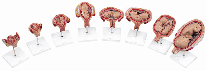3B 5th Month Twin Fetus normal position