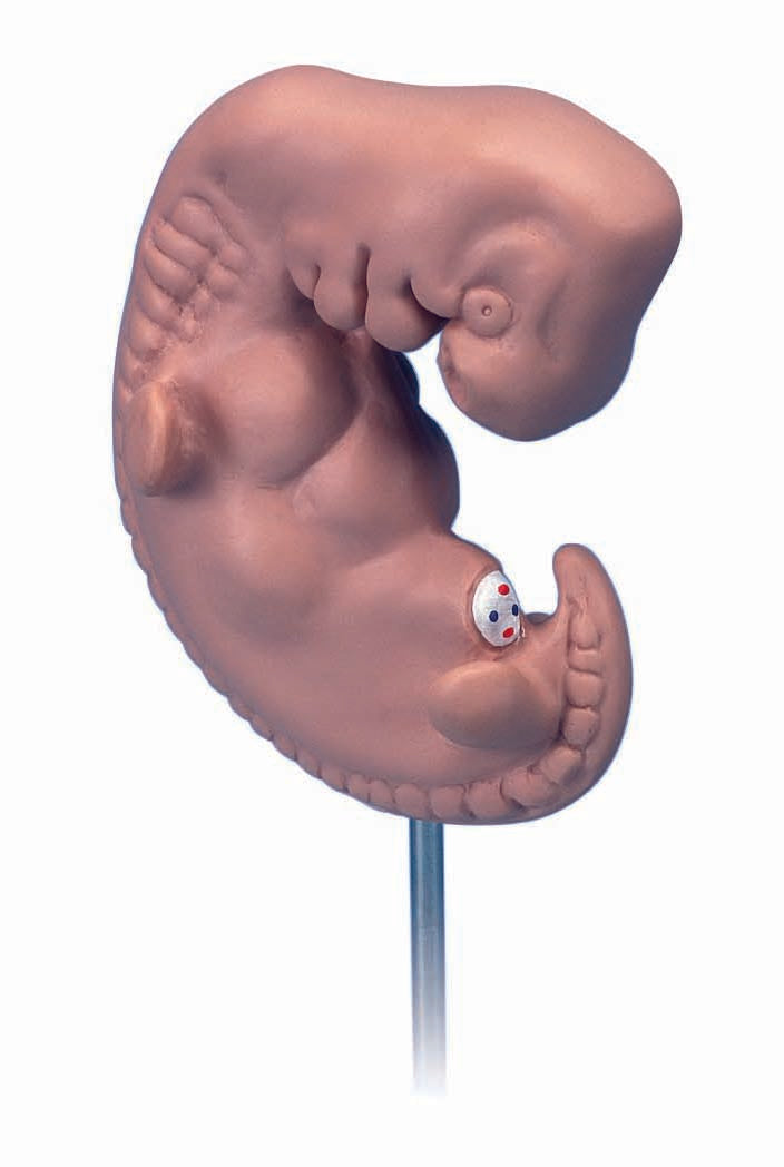 3B Embryo 25 times life-size