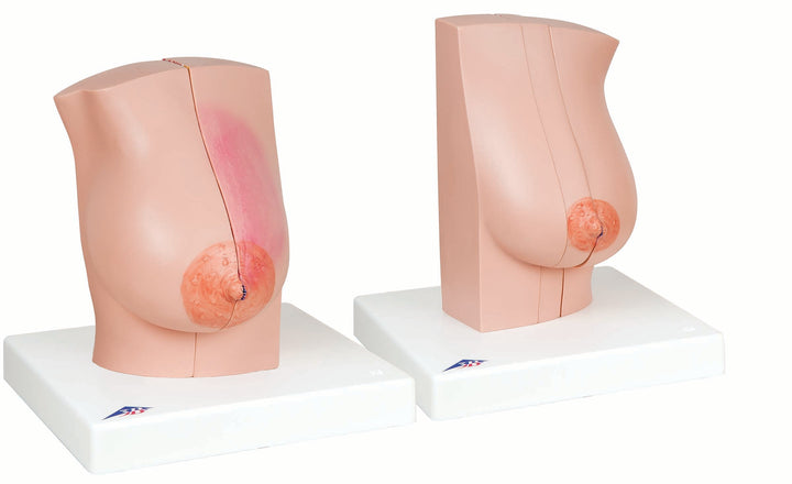 3B Model of the Female Breast