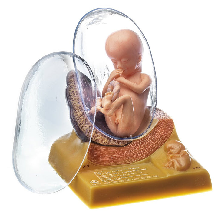 SOMSO Human Embryo in the Third Month