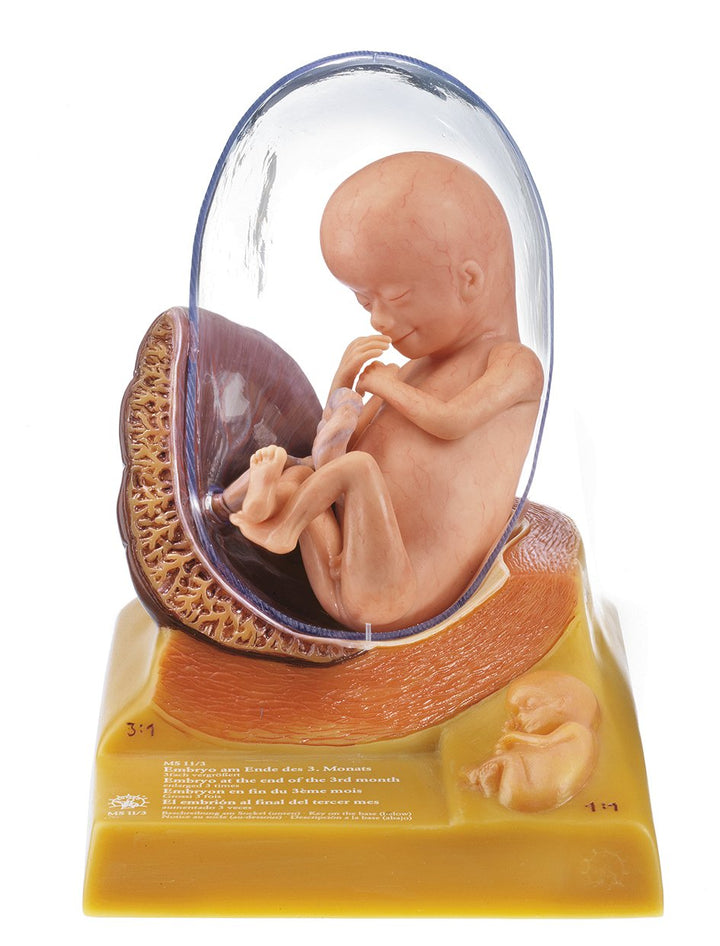 SOMSO Human Embryo in the Third Month