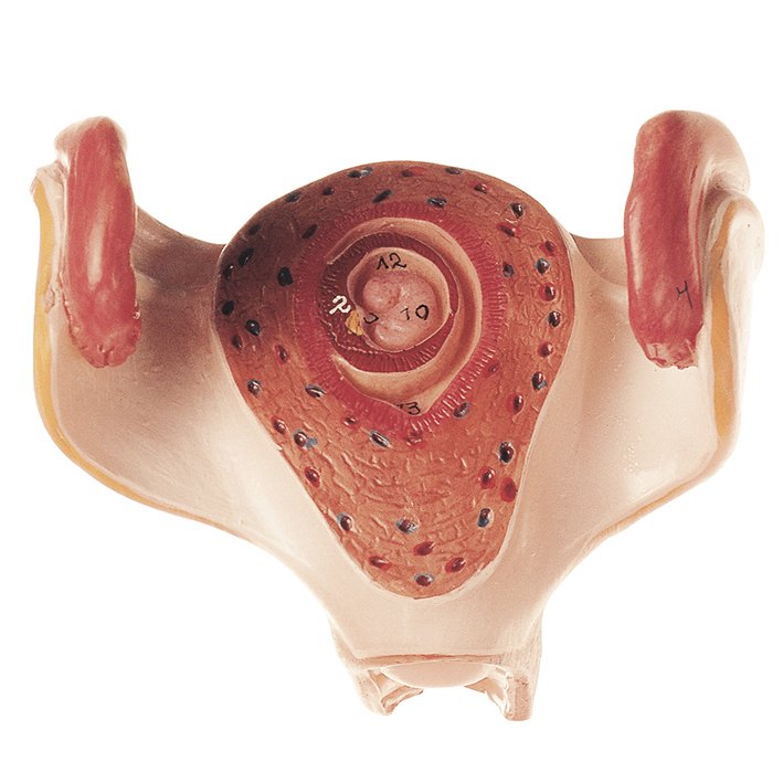 SOMSO Uterus with Embryo in First Month