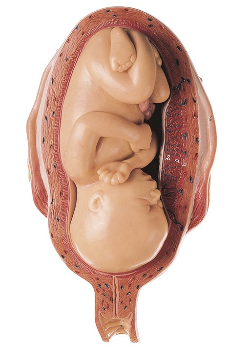 SOMSO Uterus with Fetus in Seventh Month
