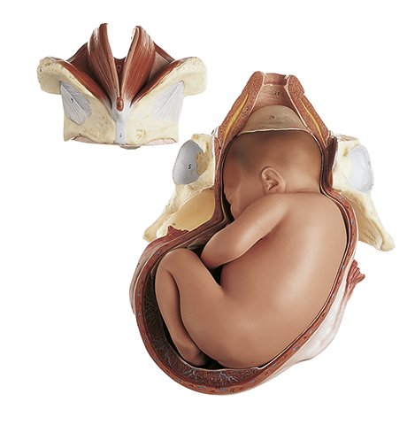 SOMSO Birth - First Stage