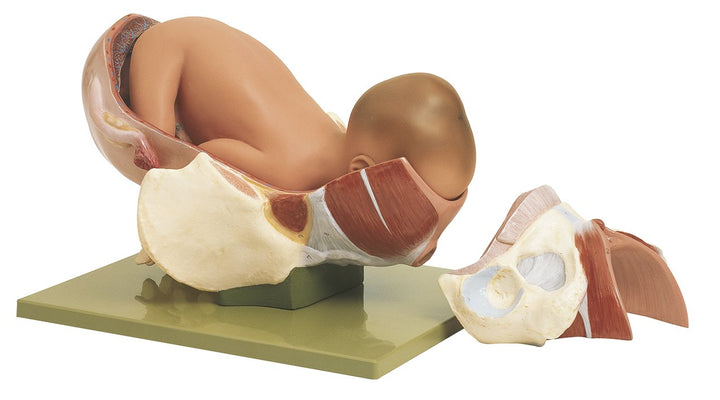 SOMSO Birth - Second Stage