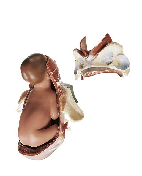 SOMSO Birth - Second Stage