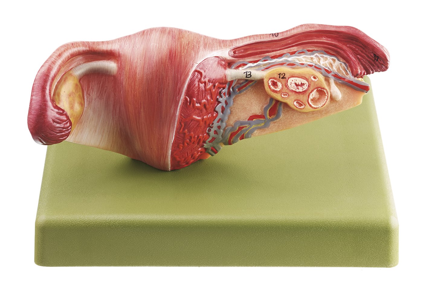 SOMSO Female Genital Organs