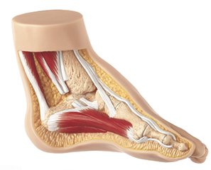 SOMSO Club-foot