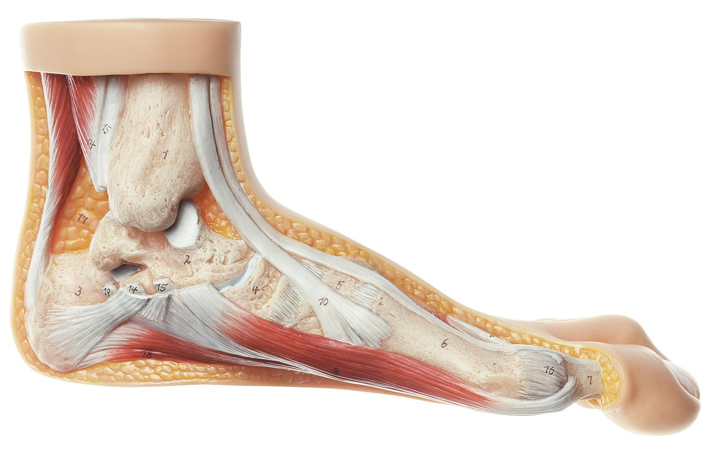 SOMSO Hallux valgus model