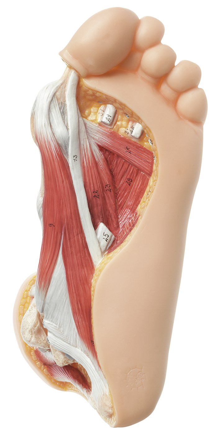 SOMSO Hallux valgus model