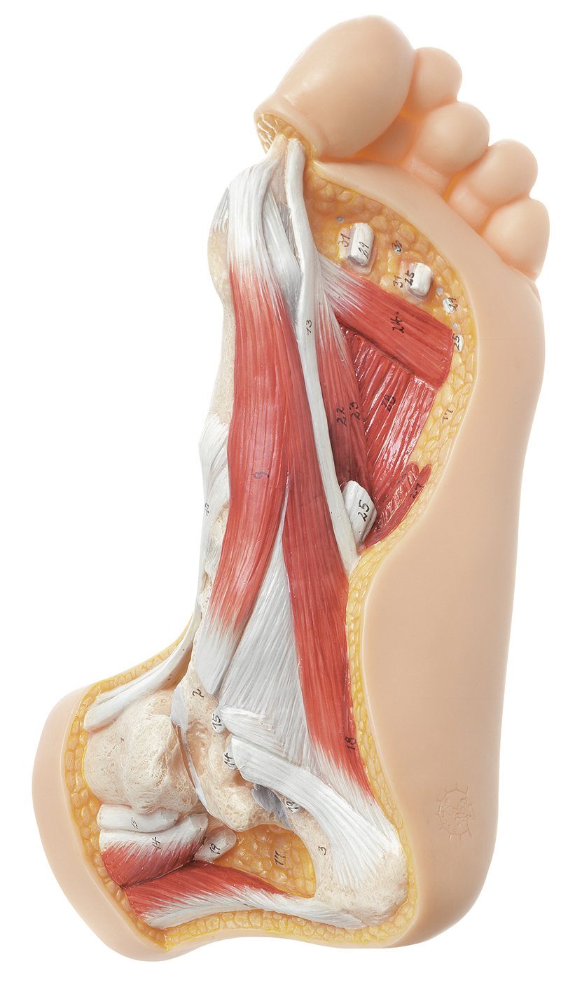 SOMSO Hallux valgus model