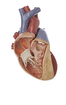 SOMSO Various Defects of the Ventricular Septum