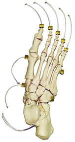 SOMSO Skeleton of the Foot on Nylon