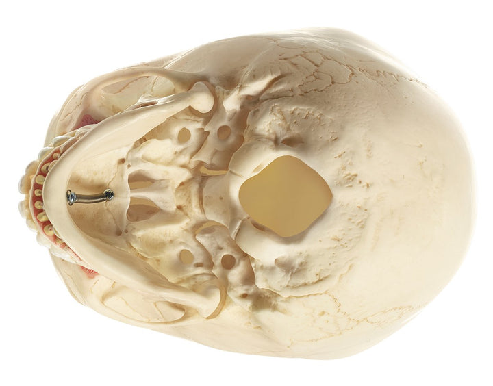 SOMSO Artificial Skull of Child