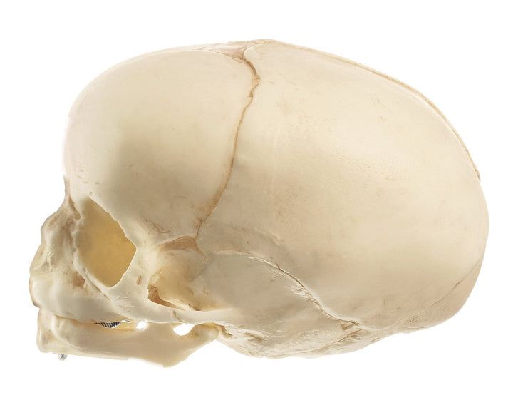 SOMSO Artificial Skull of a Fetus