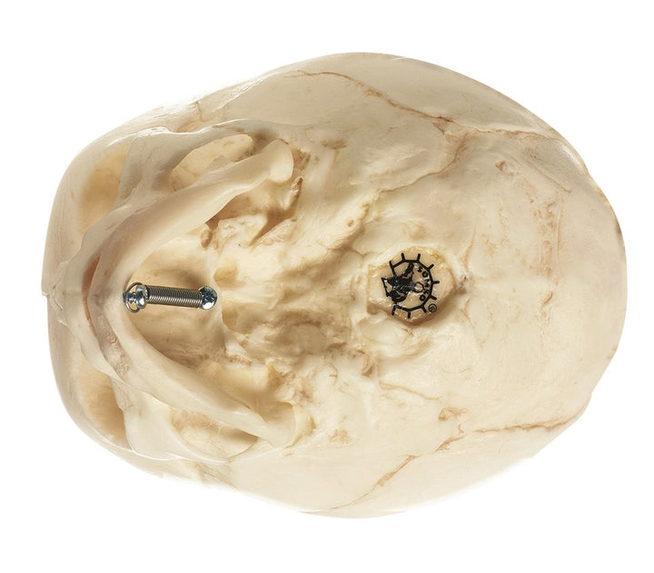 SOMSO Artificial Skull of a Fetus