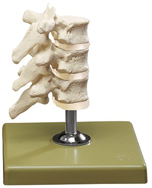 SOMSO Three Dorsal Vertebrae with Discs