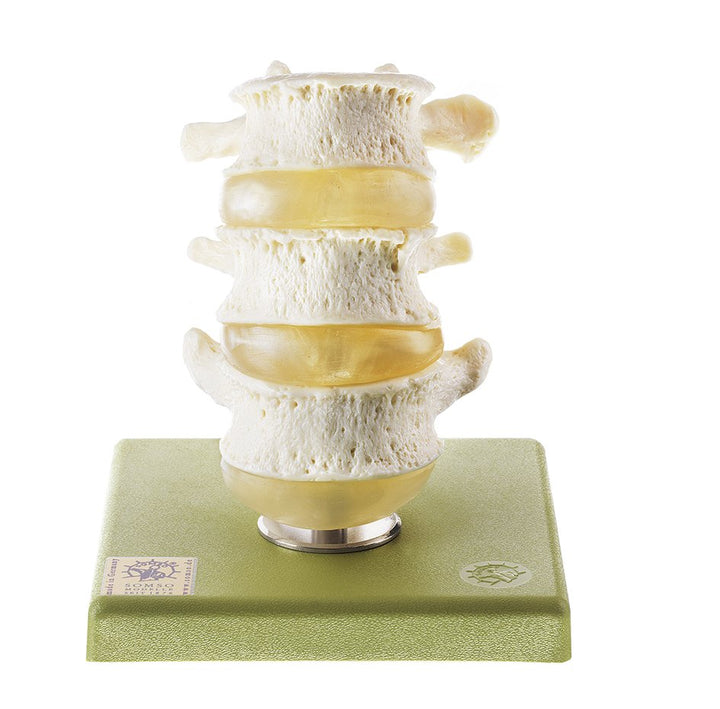 SOMSO Three Lumbar Vertebrae with Discs