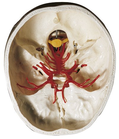 SOMSO Artificial Base of Skull with Arteries