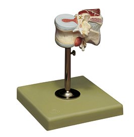 SOMSO First Lumbar Vertebra with Intervertebral Discs and Dorsal Muscles