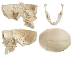 SOMSO Artificial Human Skull