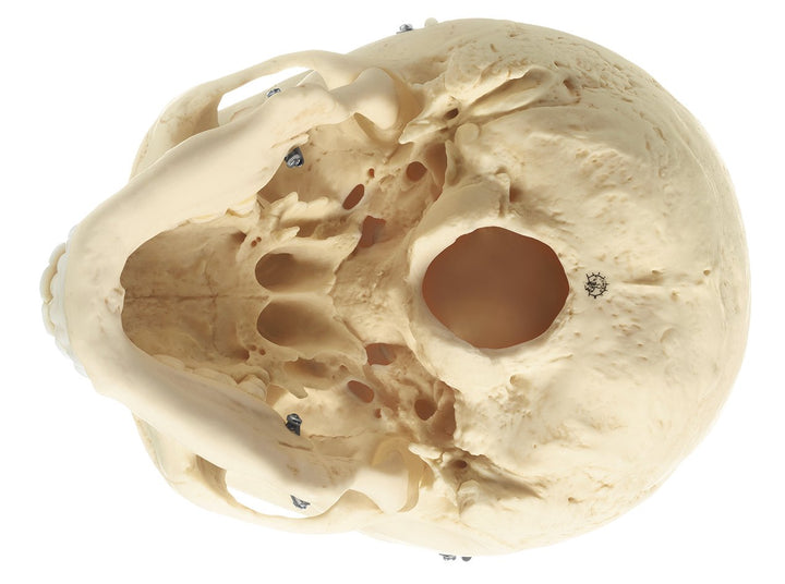 SOMSO Artificial Human Skull