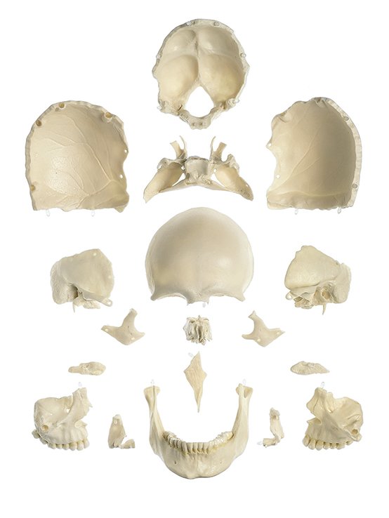 SOMSO 18-Part Model of the Skull