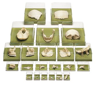 SOMSO Artificial Bauchene Skull of an Adult