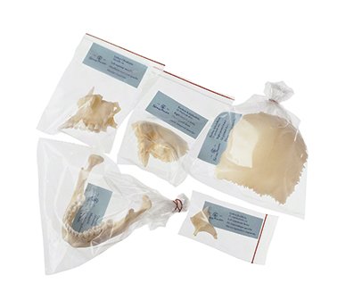 SOMSO Artificial Bauchene Skull of an Adult