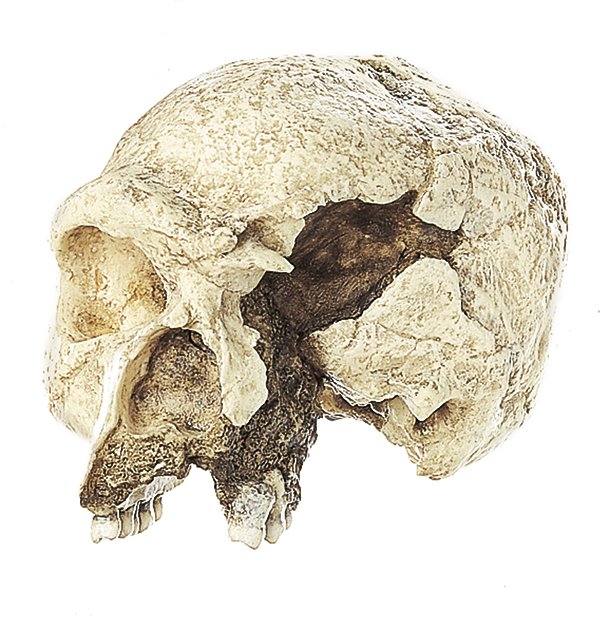 SOMSO The Steinheim Skull Homo heidelbergensis
