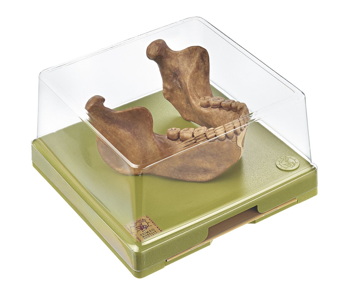 SOMSO Lower Jaw from Mauer near Heidelberg, Homo heidelbergensis