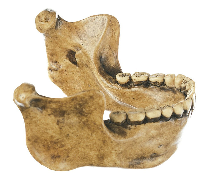 SOMSO Lower Jaw from Mauer near Heidelberg, Homo heidelbergensis