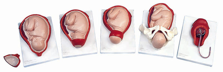 3B 5-Stage Birth Process Model