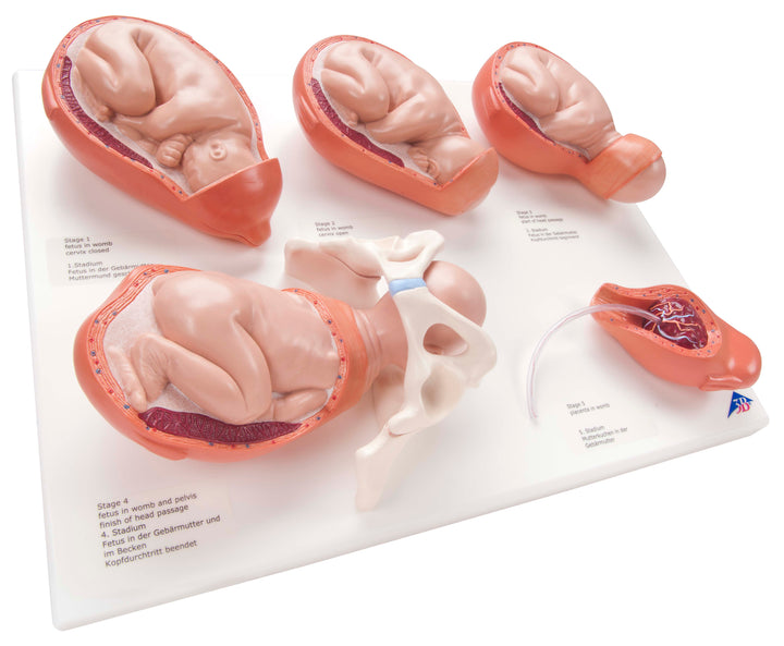 3B 5-Stage Birth Process Model