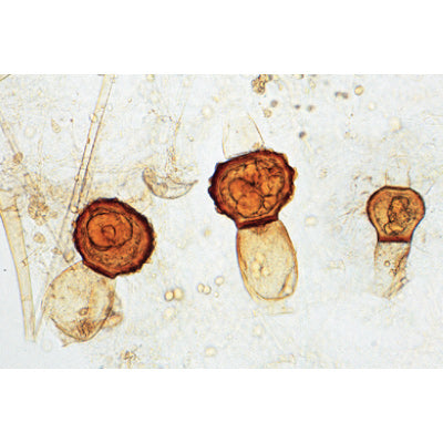 3B Fungi-Lichen M'scope Slides 20 Slides w/ Text