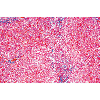 3B Human Pathology Basic Set Micr. Slides/ Set of 50
